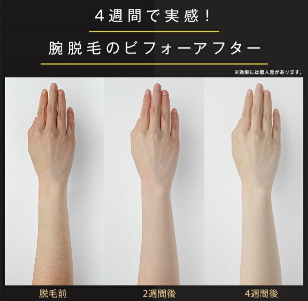 JOVS Dora 脱毛器 1.1 エメラルドグリーン